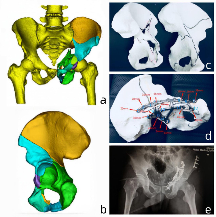 Fig 6