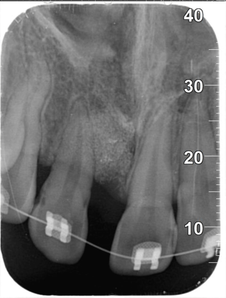 Figure 11