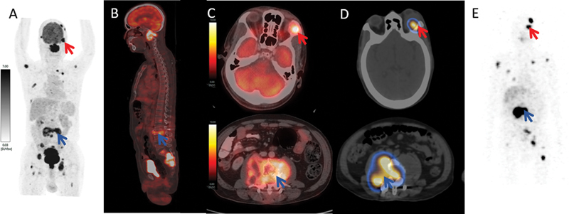 Fig. 2