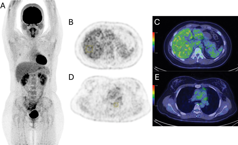 Fig. 1