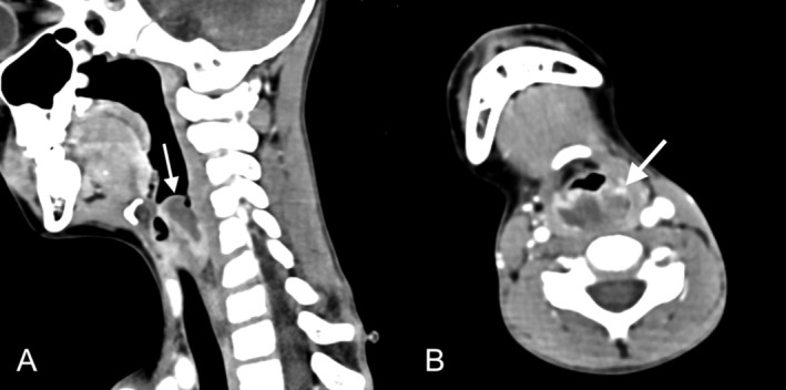 FIGURE 2