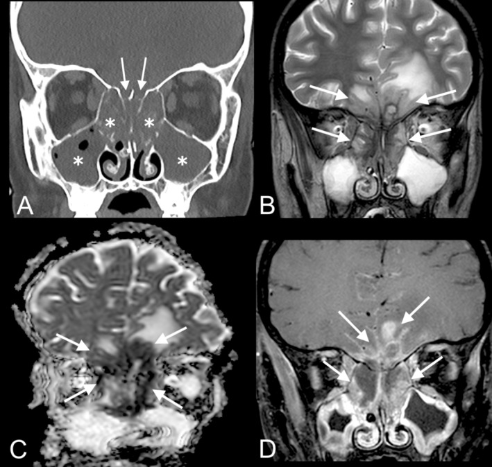 FIGURE 3