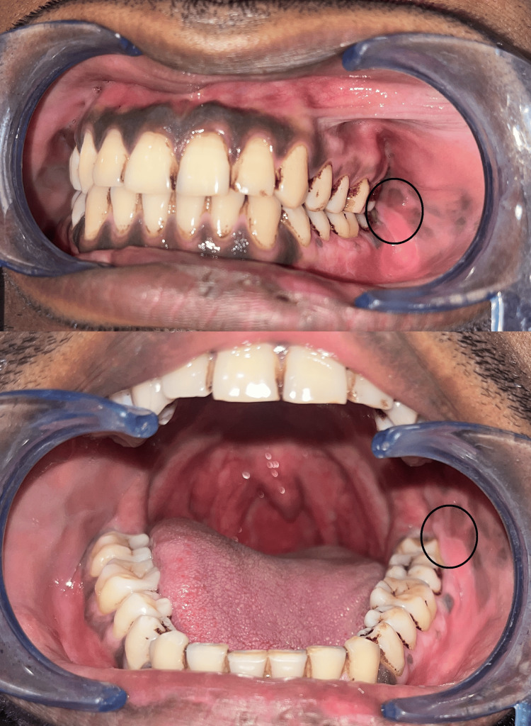 Figure 6