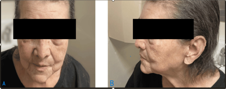 Figure 10