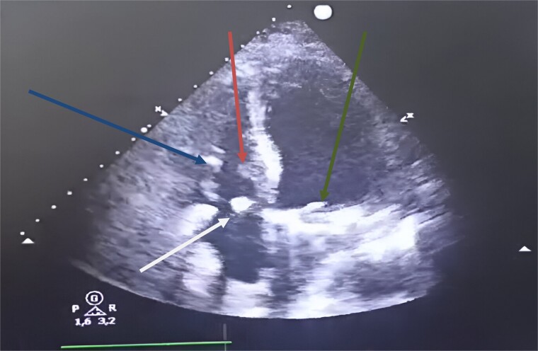 Figure 4