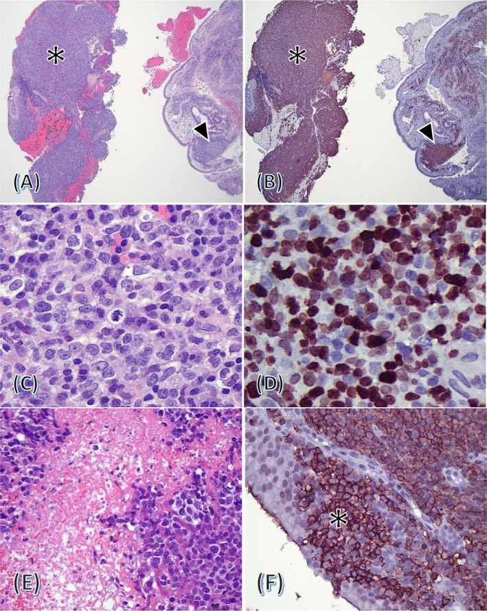 FIGURE 2