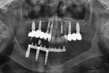 Figure 9