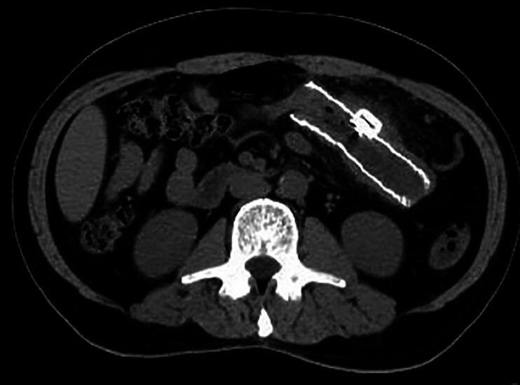 Fig. 3