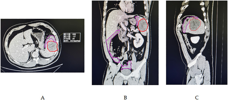 Figure 2