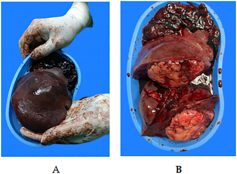 Figure 3