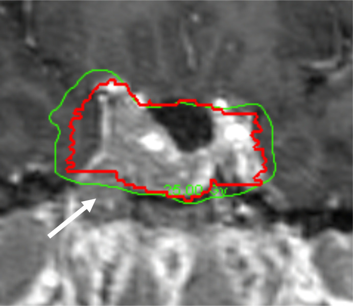 Figure 4