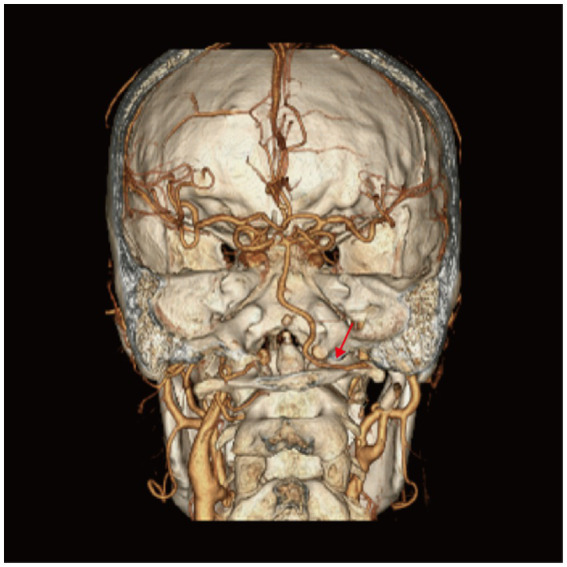 Figure 4