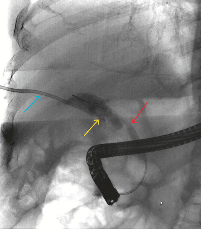 Fig. 2