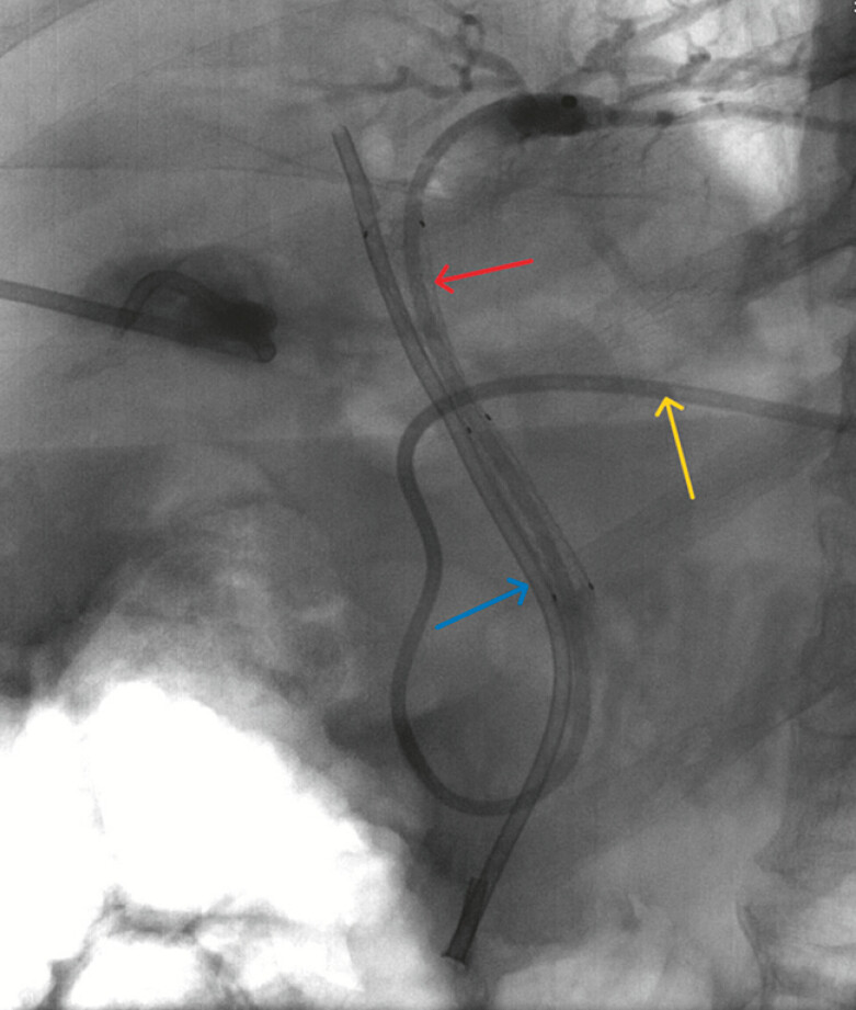 Fig. 4