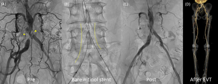 FIGURE 2