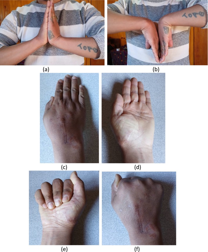 FIGURE 6