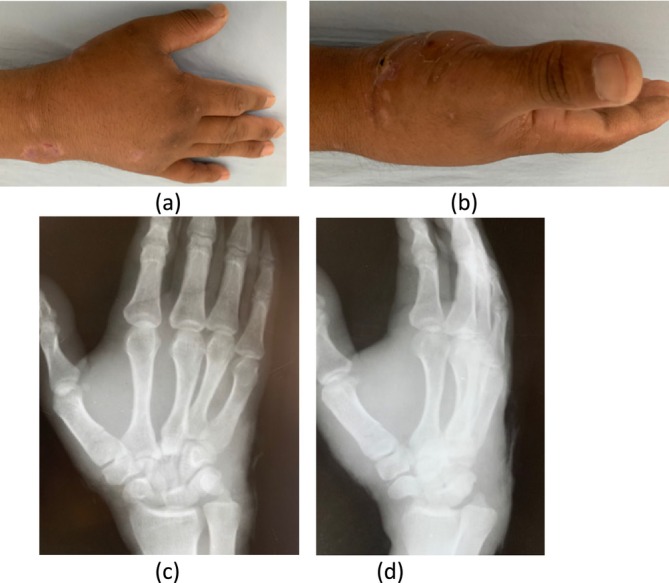 FIGURE 1