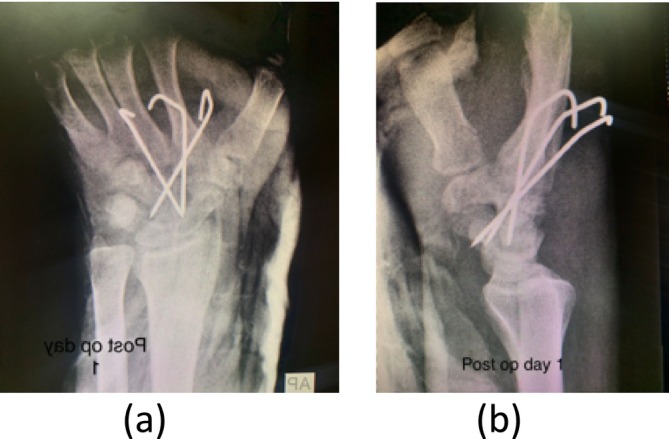 FIGURE 4