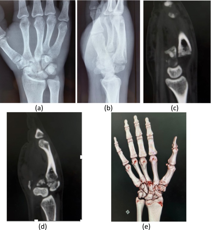 FIGURE 2