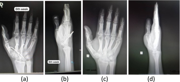 FIGURE 5