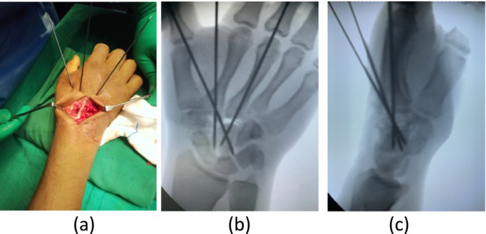FIGURE 3