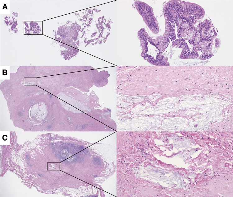 Fig. 4