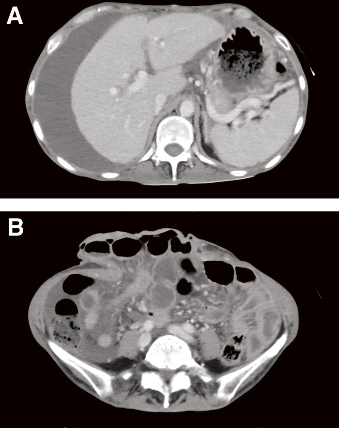 Fig. 2