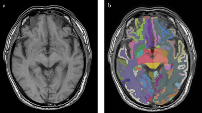 FIGURE 2