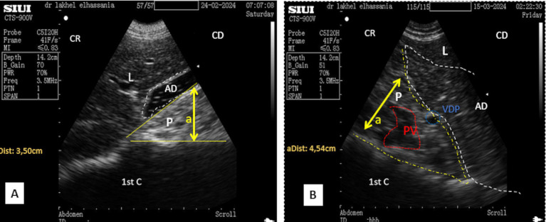 Figure 9