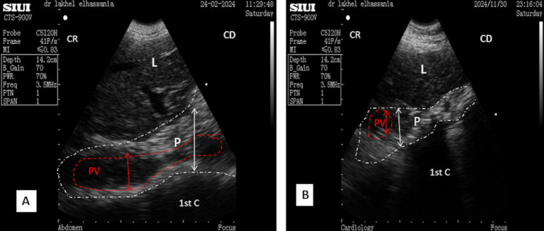 Figure 10