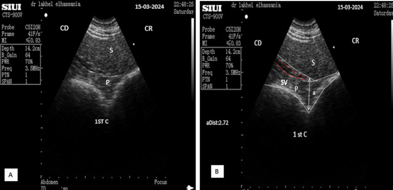 Figure 11