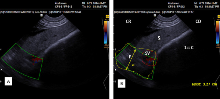 Figure 12