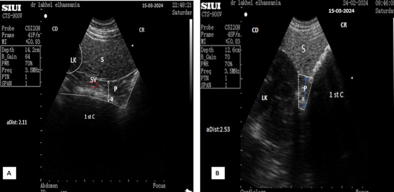 Figure 13
