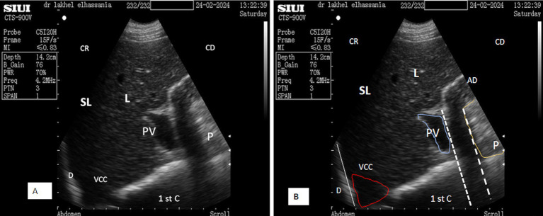 Figure 14