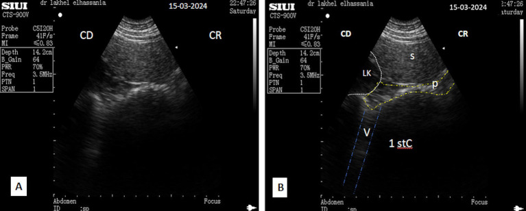 Figure 15