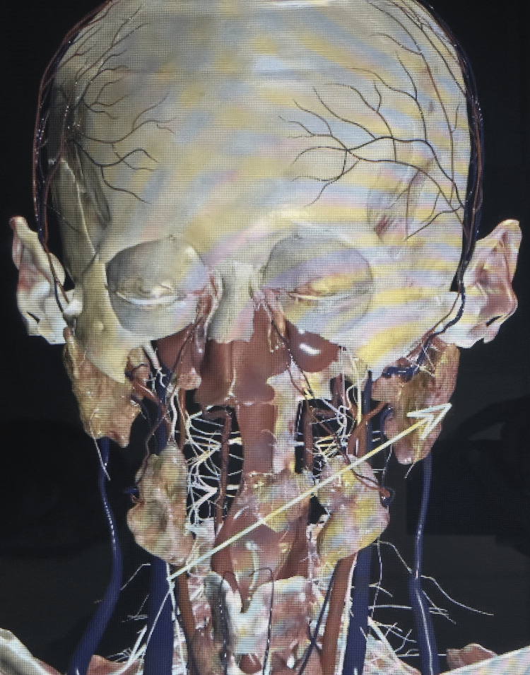 Figure 6