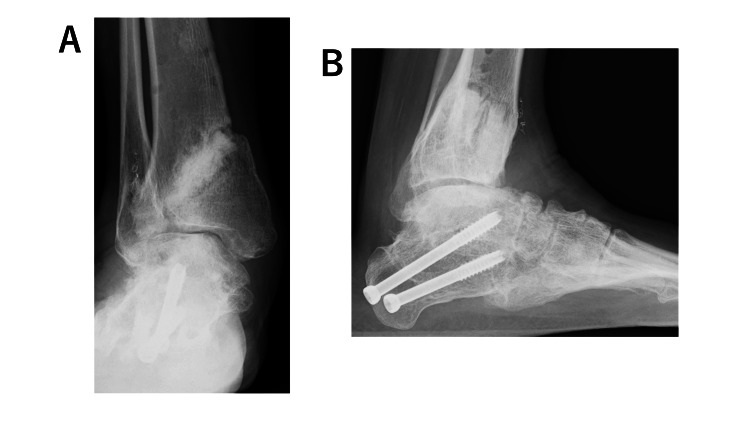 Figure 4
