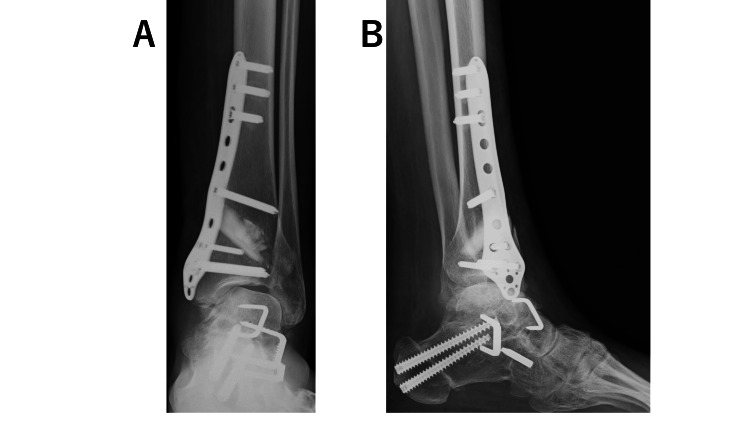 Figure 5