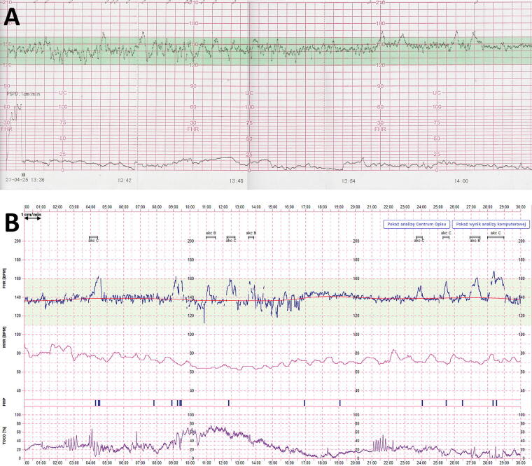 FIG. 3