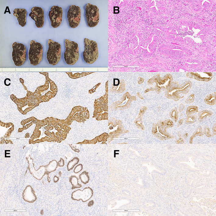 FIGURE 2