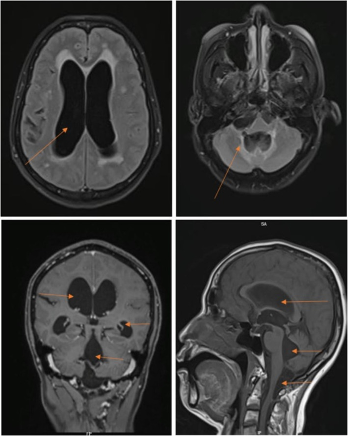FIGURE 1