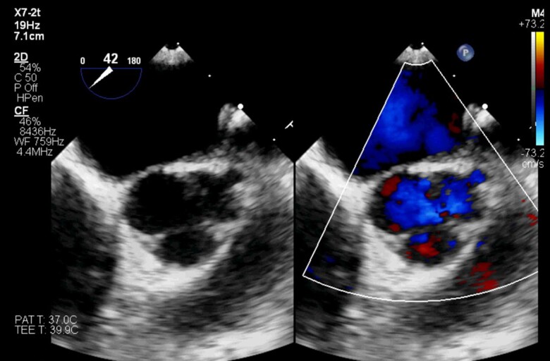 Figure 5