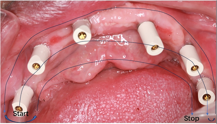 Figure 2