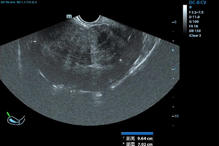 Figure 1