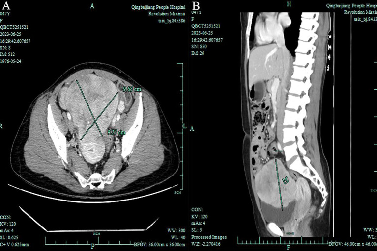Figure 2