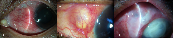 Figure 3
