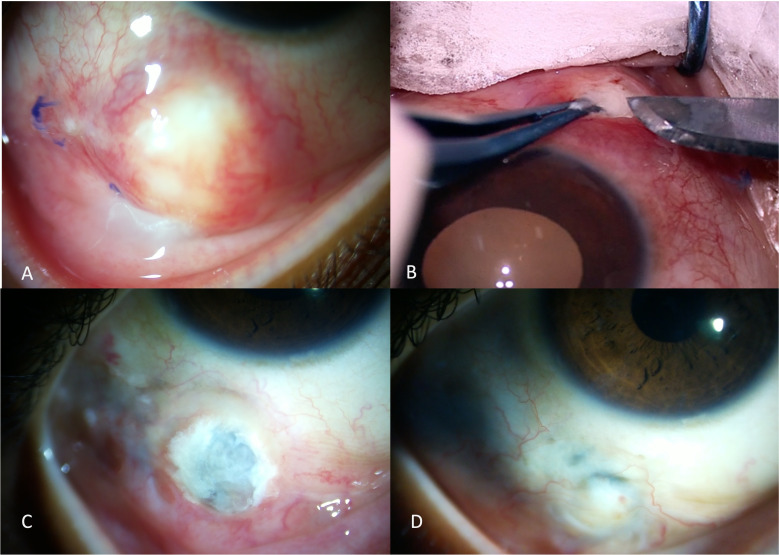 Figure 4