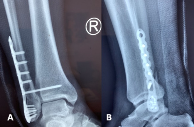 FIGURE 2