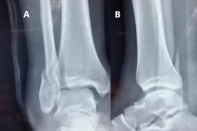FIGURE 1