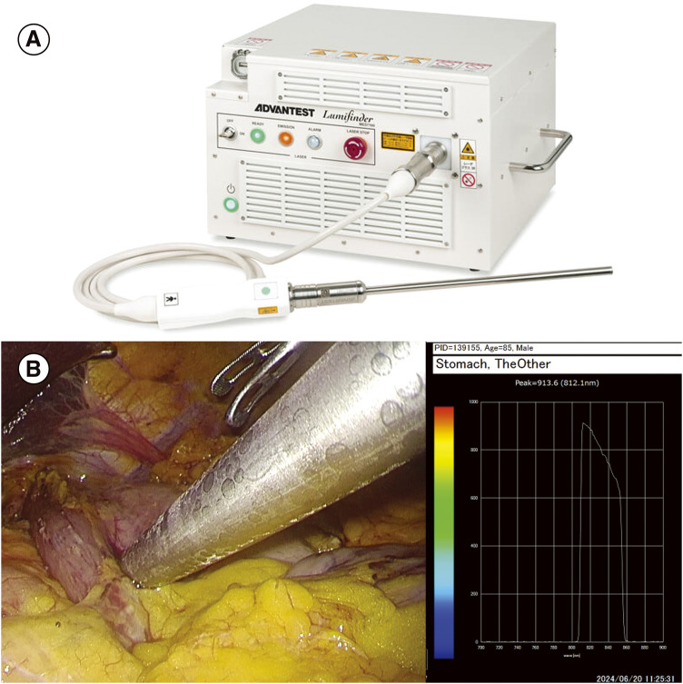 Fig. 2